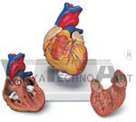 Classic Heart, 2 part